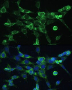 Invitrogen COX6A1 Polyclonal Antibody 100 &mu;L; Unconjugated:Antibodies,