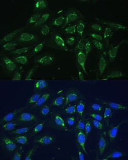 Invitrogen COX6A1 Polyclonal Antibody 100 &mu;L; Unconjugated:Antibodies,