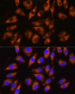 Invitrogen GRK5 Polyclonal Antibody 100 &mu;L; Unconjugated:Antibodies,