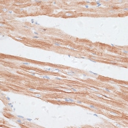 Invitrogen GRK5 Polyclonal Antibody 100 &mu;L; Unconjugated:Antibodies,