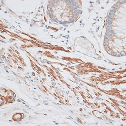 Invitrogen GRK5 Polyclonal Antibody 100 &mu;L; Unconjugated:Antibodies,