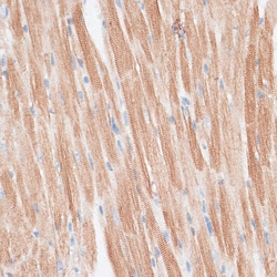 Invitrogen GRK5 Polyclonal Antibody 100 &mu;L; Unconjugated:Antibodies,