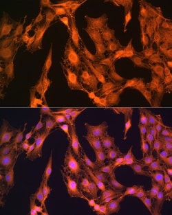 Invitrogen LASP1 Polyclonal Antibody 100 &mu;L; Unconjugated:Antibodies,