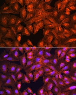 Invitrogen LASP1 Polyclonal Antibody 100 &mu;L; Unconjugated:Antibodies,