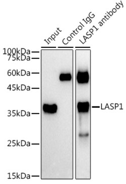 Invitrogen LASP1 Polyclonal Antibody 100 &mu;L; Unconjugated:Antibodies,