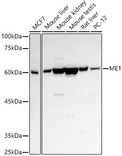 Invitrogen ME1 Polyclonal Antibody 100 &mu;L; Unconjugated:Antibodies,