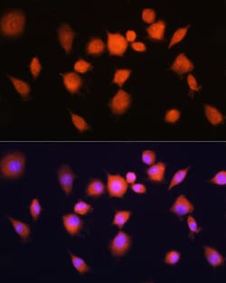 Invitrogen PGAM1 Polyclonal Antibody 100 &mu;L; Unconjugated:Antibodies,