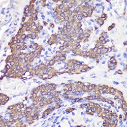 Invitrogen UBL3 Polyclonal Antibody 100 &mu;L; Unconjugated:Antibodies,
