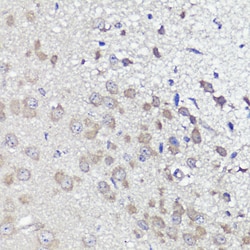 Invitrogen UBL3 Polyclonal Antibody 100 &mu;L; Unconjugated:Antibodies,