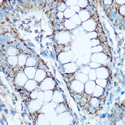 Invitrogen UQCRC2 Polyclonal Antibody 100 &mu;L; Unconjugated:Antibodies,