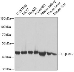 Invitrogen UQCRC2 Polyclonal Antibody 100 &mu;L; Unconjugated:Antibodies,