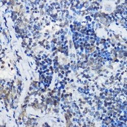 Invitrogen MYBBP1A Polyclonal Antibody 100 &mu;L | Buy Online | Invitrogen&trade; | Fisher Scientific