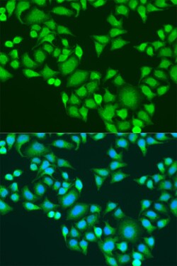 IGF2BP3 Polyclonal Antibody:Antibodies, Polyclonal