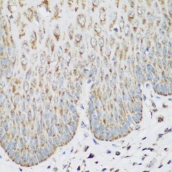 IGF2BP3 Polyclonal Antibody:Antibodies, Polyclonal
