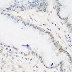 IGF2BP3 Polyclonal Antibody:Antibodies, Polyclonal