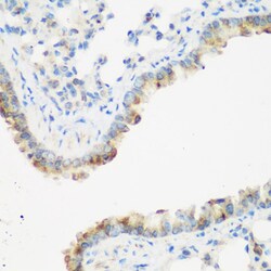 IGF2BP3 Polyclonal Antibody:Antibodies, Polyclonal