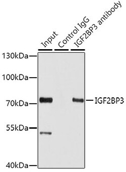 IGF2BP3 Polyclonal Antibody:Antibodies, Polyclonal