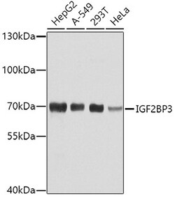 IGF2BP3 Polyclonal Antibody:Antibodies, Polyclonal