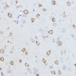 Invitrogen TCP-1 theta Polyclonal Antibody 100 &mu;L; Unconjugated:Antibodies,