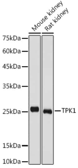 Invitrogen TPK1 Polyclonal Antibody 100 &mu;L; Unconjugated:Antibodies,