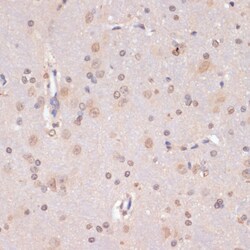 Invitrogen PIDD Polyclonal Antibody 100 &mu;L; Unconjugated:Antibodies,