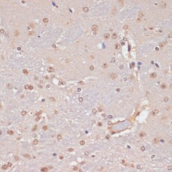 Invitrogen PIDD Polyclonal Antibody 100 &mu;L; Unconjugated:Antibodies,