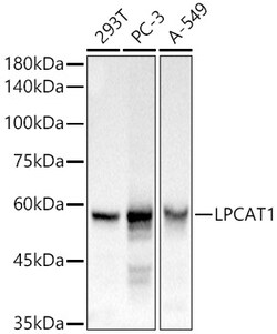 Invitrogen LPCAT1 Polyclonal Antibody 100 &mu;L; Unconjugated:Antibodies,