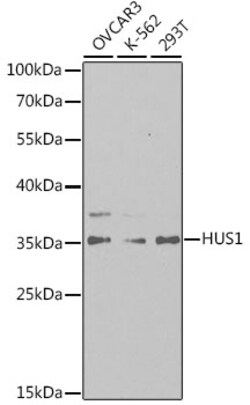 Invitrogen HUS1 Polyclonal Antibody 100 &mu;L; Unconjugated:Antibodies,