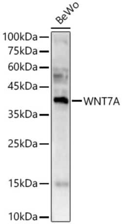 Invitrogen WNT7A Polyclonal Antibody 100 &mu;L; Unconjugated:Antibodies,