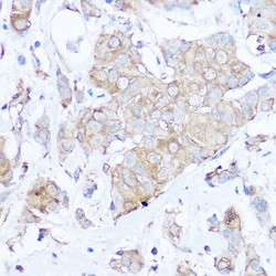 Invitrogen MGP Polyclonal Antibody 100 &mu;L; Unconjugated:Antibodies,