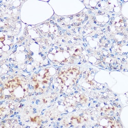 Invitrogen MGP Polyclonal Antibody 100 &mu;L; Unconjugated:Antibodies,