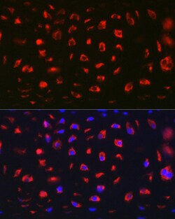 Invitrogen MGP Polyclonal Antibody 100 &mu;L; Unconjugated:Antibodies,