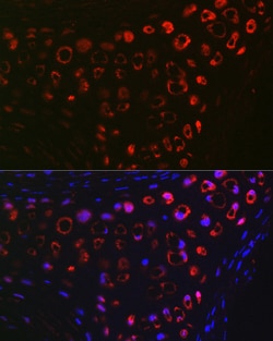 Invitrogen MGP Polyclonal Antibody 100 &mu;L; Unconjugated:Antibodies,