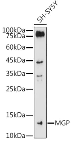 Invitrogen MGP Polyclonal Antibody 100 &mu;L; Unconjugated:Antibodies,