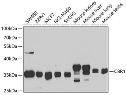 Invitrogen CBR1 Polyclonal Antibody 100 &mu;L; Unconjugated:Antibodies,