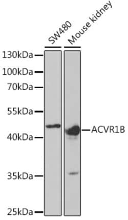 Invitrogen ACVR1B Polyclonal Antibody 100 &mu;L; Unconjugated:Antibodies,