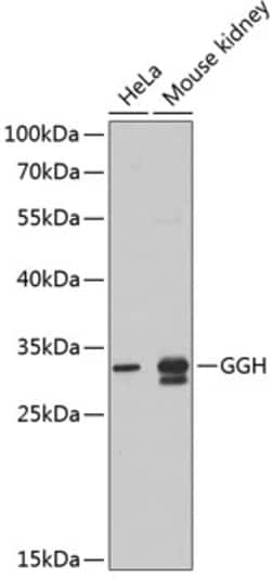 Invitrogen GGH Polyclonal Antibody 100 &mu;L | Buy Online | Invitrogen&trade; | Fisher Scientific