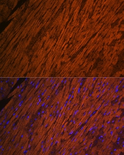 Invitrogen MYL2 Polyclonal Antibody 100 &mu;L; Unconjugated:Antibodies,