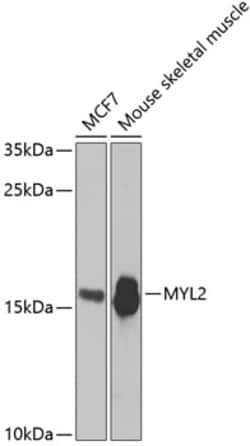Invitrogen MYL2 Polyclonal Antibody 100 &mu;L; Unconjugated:Antibodies,