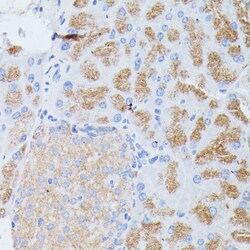 Invitrogen PLA2 Polyclonal Antibody 100 &mu;L; Unconjugated:Antibodies,