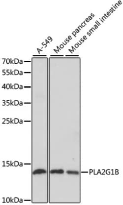 Invitrogen PLA2 Polyclonal Antibody 100 &mu;L; Unconjugated:Antibodies,