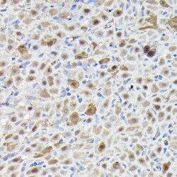 Invitrogen SNRPE Polyclonal Antibody 100 &mu;L; Unconjugated:Antibodies,