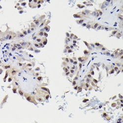 Invitrogen SNRPE Polyclonal Antibody 100 &mu;L; Unconjugated:Antibodies,
