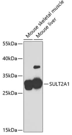 SULT2A1 Polyclonal Antibody:Antibodies, Polyclonal