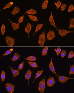 Invitrogen TrxR2 Polyclonal Antibody 100 &mu;L; Unconjugated:Antibodies,