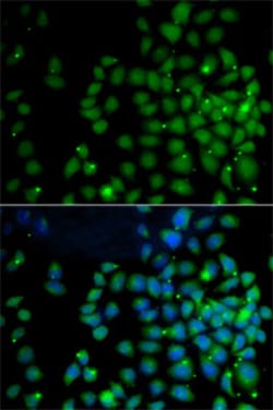 Invitrogen UBD Polyclonal Antibody 100 &mu;L; Unconjugated:Antibodies,