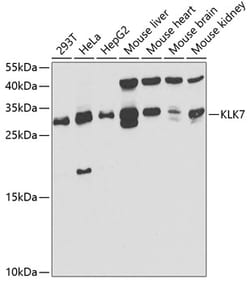 Invitrogen Kallikrein 7 Polyclonal Antibody 100 &mu;L | Buy Online | Invitrogen&trade; | Fisher Scientific