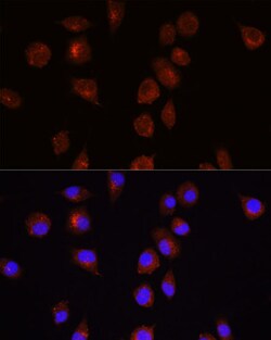 Invitrogen AKT1 Polyclonal Antibody 100 &mu;L; Unconjugated:Antibodies,
