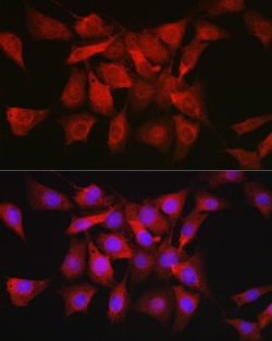 Invitrogen AKT1 Polyclonal Antibody 100 &mu;L; Unconjugated:Antibodies,