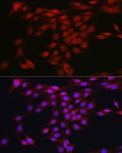 Invitrogen AKT1 Polyclonal Antibody 100 &mu;L; Unconjugated:Antibodies,